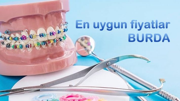 Dis implant fiyatları